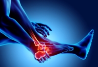 Dealing With Rheumatoid Arthritis Flare Ups