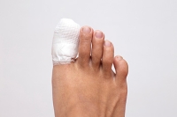 Can I Run With a Broken Toe?
